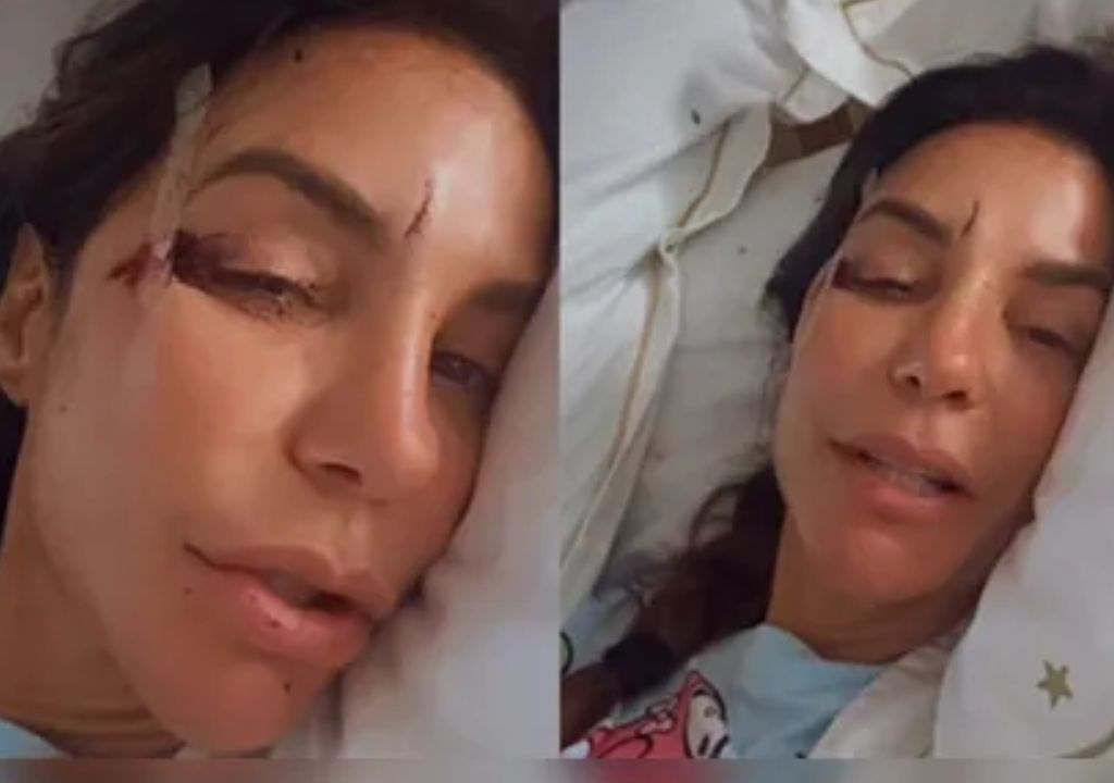 Ivete Sangalo internada em Salvador após desmaio causado por desidratação e virose